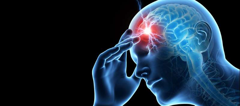 Headache treatment in Dee Why Northern Beaches