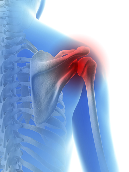 Shoulder injury treatment in Dee Why