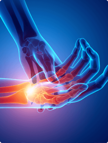 Wrist and Hand injuries treatment in Dee Why