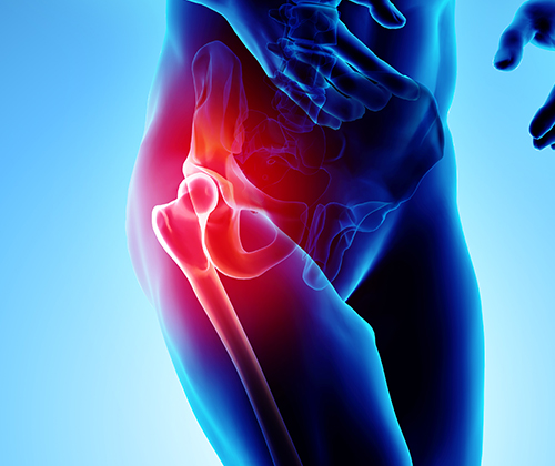 Hip Injury treatment in Dee Why