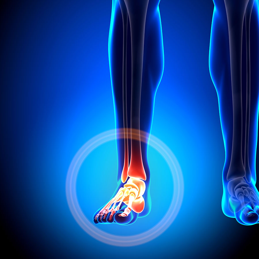 Foot and Ankle Injury treatment in Dee Why